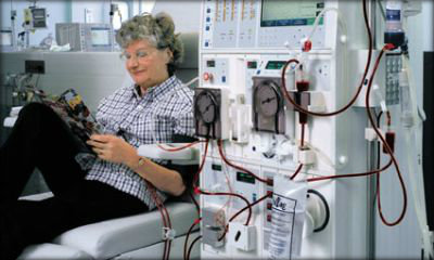 Una donna seduta che sta facendo la dialisi